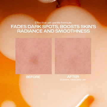 Dark Spot Serum